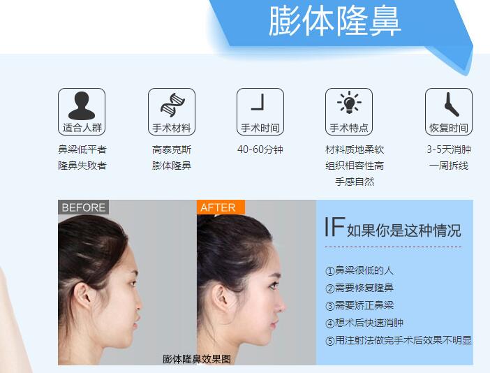 南京做膨体隆鼻效果好吗?