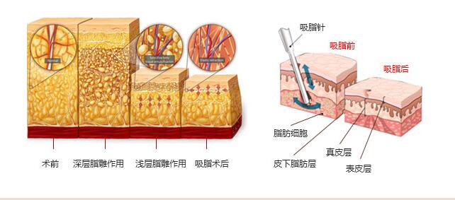 改善双下巴用什么方法好?