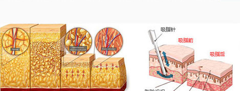 瘦腿的方法有哪些